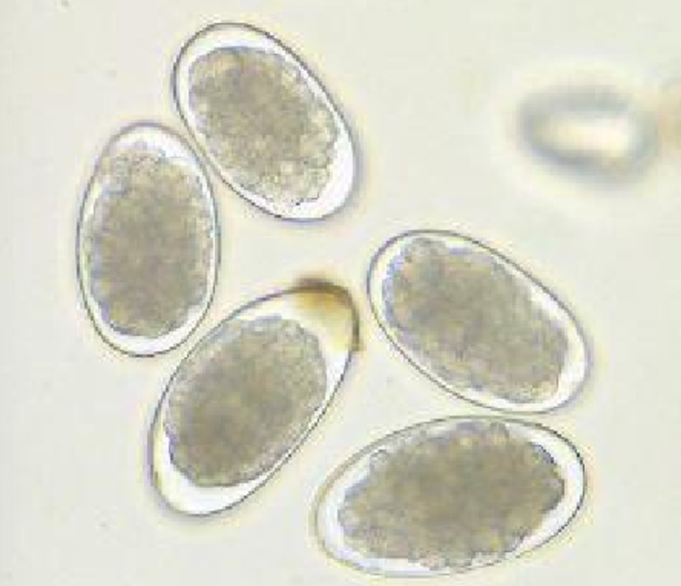 <p>Sheep, Goats, Cattle</p><p>Abomasum, Small Intestine</p>