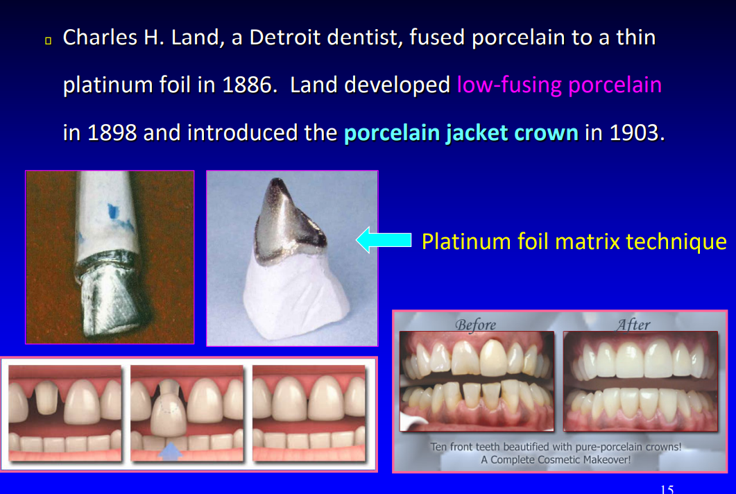 <p>low-fusing porcelain and introduced porcelain jacket crown </p>