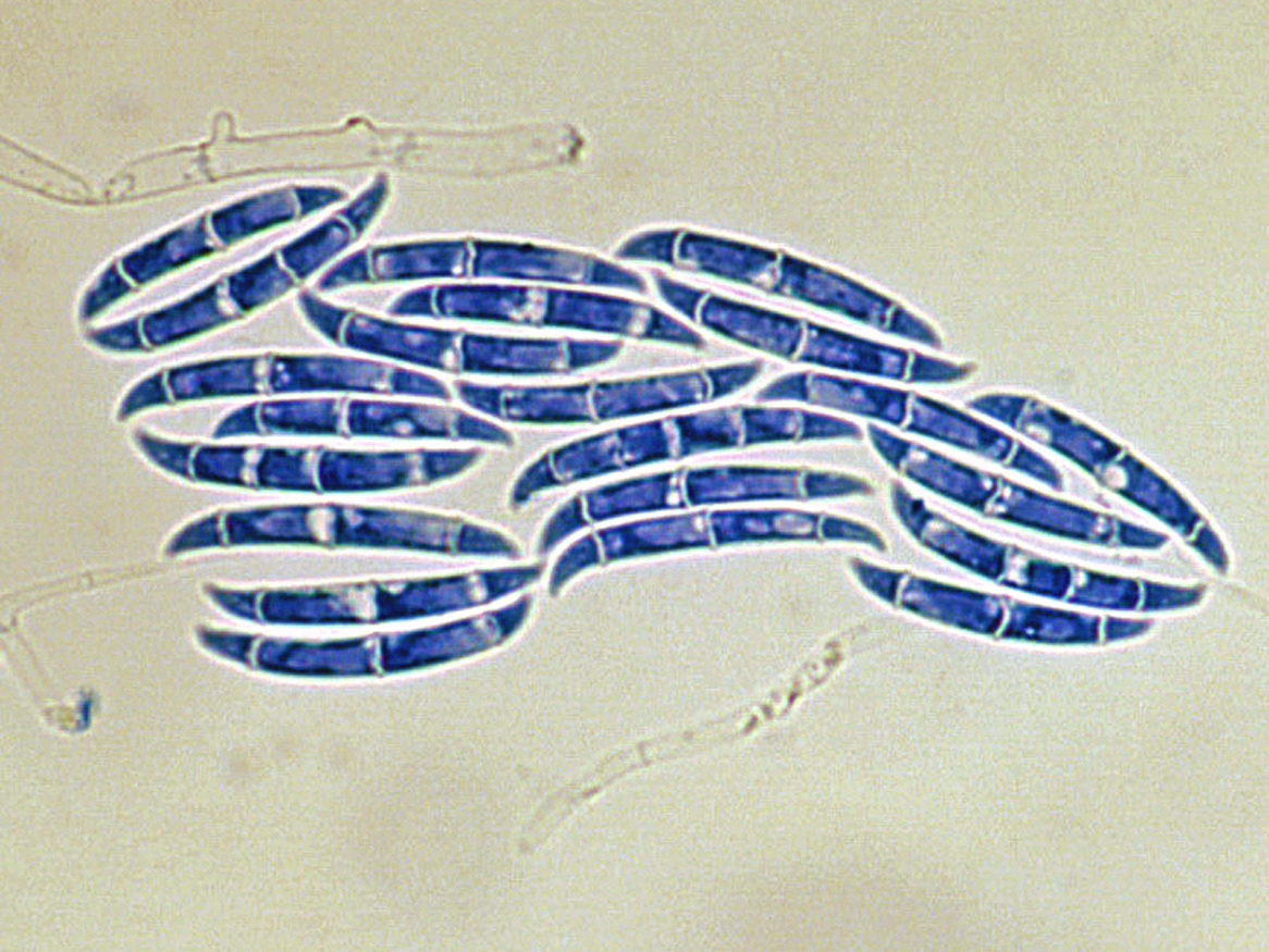 <p>What opportunistic mold looks like green beans?</p>