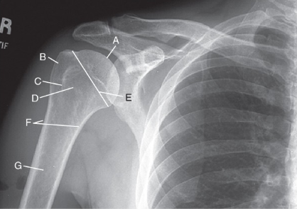 <p>label the anatomy accordingly A-G, the projection/part, and rotation if applicable </p>