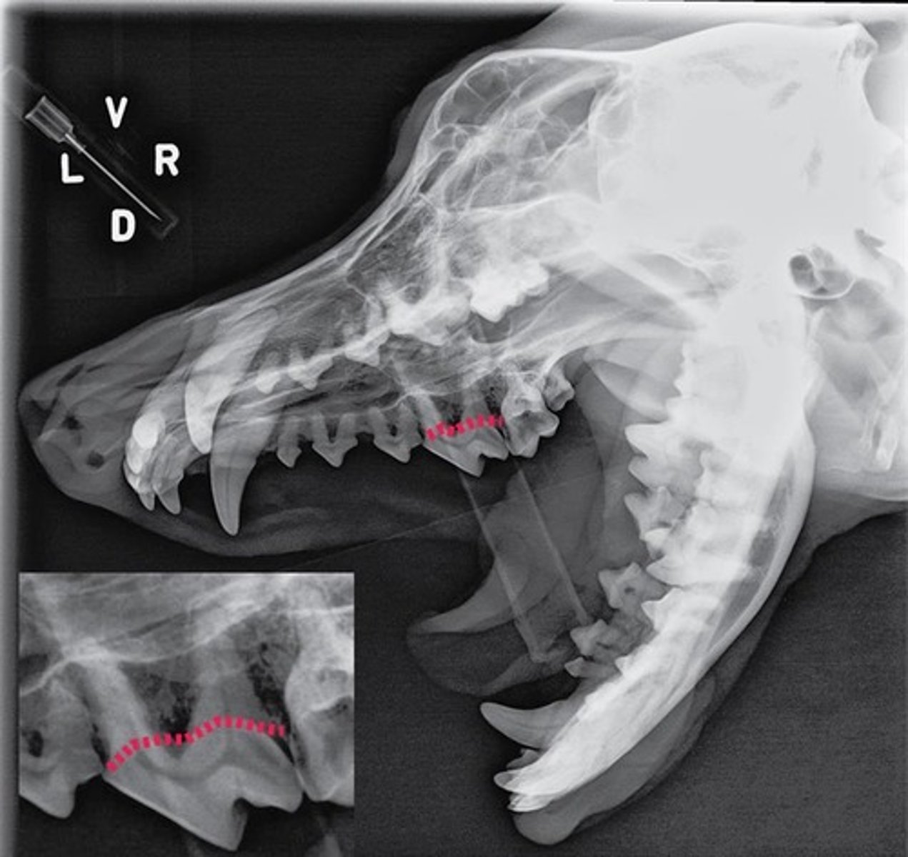 <p>What compound covers the external part of the tooth outlined?</p>