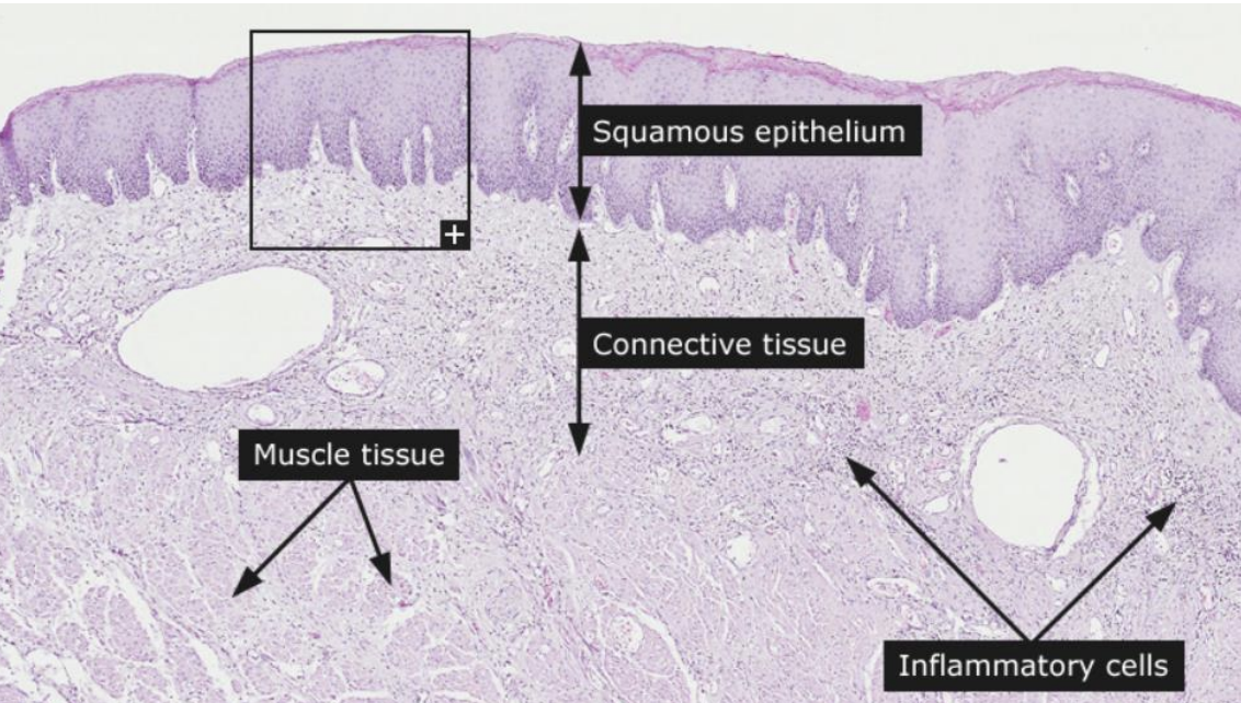 Oral Cavity - Epithelial lining is what? 
