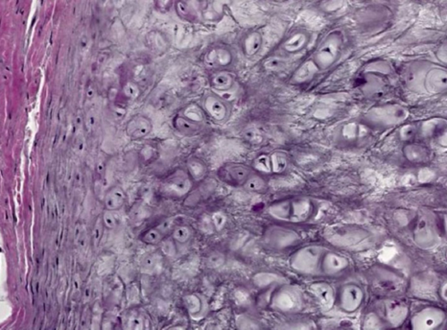 <p>identify the cartilage:</p>
