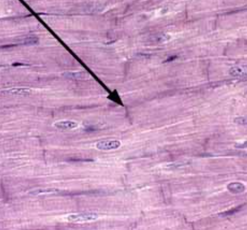 <p>Identify this trait of cardiac muscle</p>