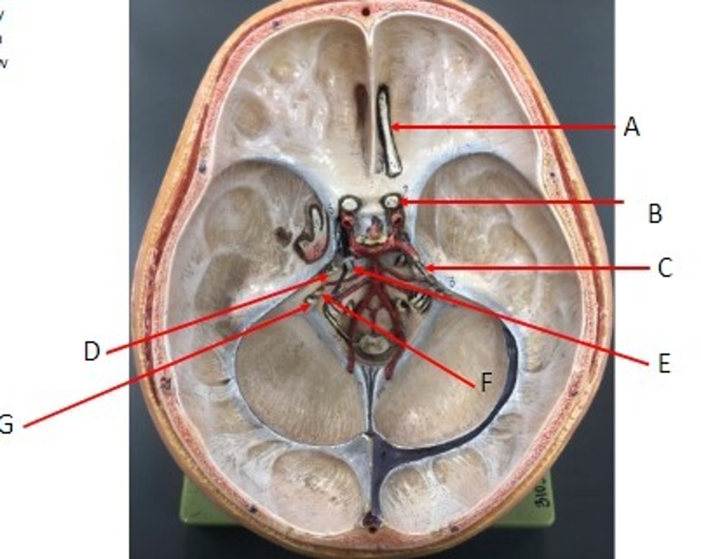 <p>Identify the Nerves</p>