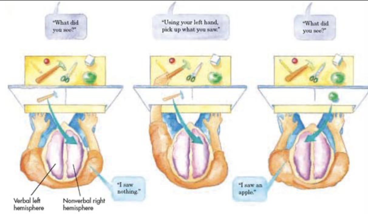 <ul><li><p>The two halves of the brain&nbsp;</p><ul><li><p>work with individuals who haev the&nbsp;“split-brain” operation (severing the corpus callosum) to control seizures provides evidence that the two hemispheres are highly specialized&nbsp;</p></li></ul></li></ul><p>The two halves of the brain…</p><ul><li><p>The right hemisphere communicates with the left in order to name the objects in its visual field&nbsp;</p></li><li><p>the left hemisphere works with the right to synthesize details into a whole picture (e.g. combining the parts of a face into a whole recognizable image)&nbsp;</p></li></ul><p></p>
