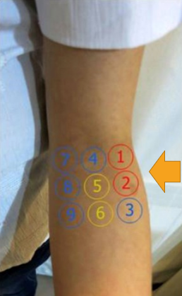 <p>Radial Nerve (Tunnel) Syndrome sx presentation includes Diffuse lateral elbow pain, esp w/</p>