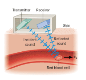 <p>Doppler ultrasound</p>