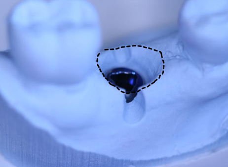 <p>Emergence profile</p>