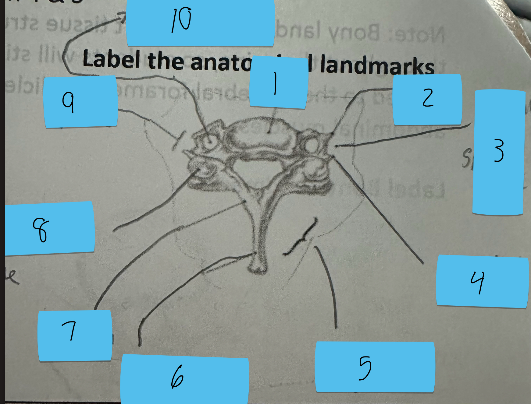 <p>Identify this structure and anatomical significance (7)</p>