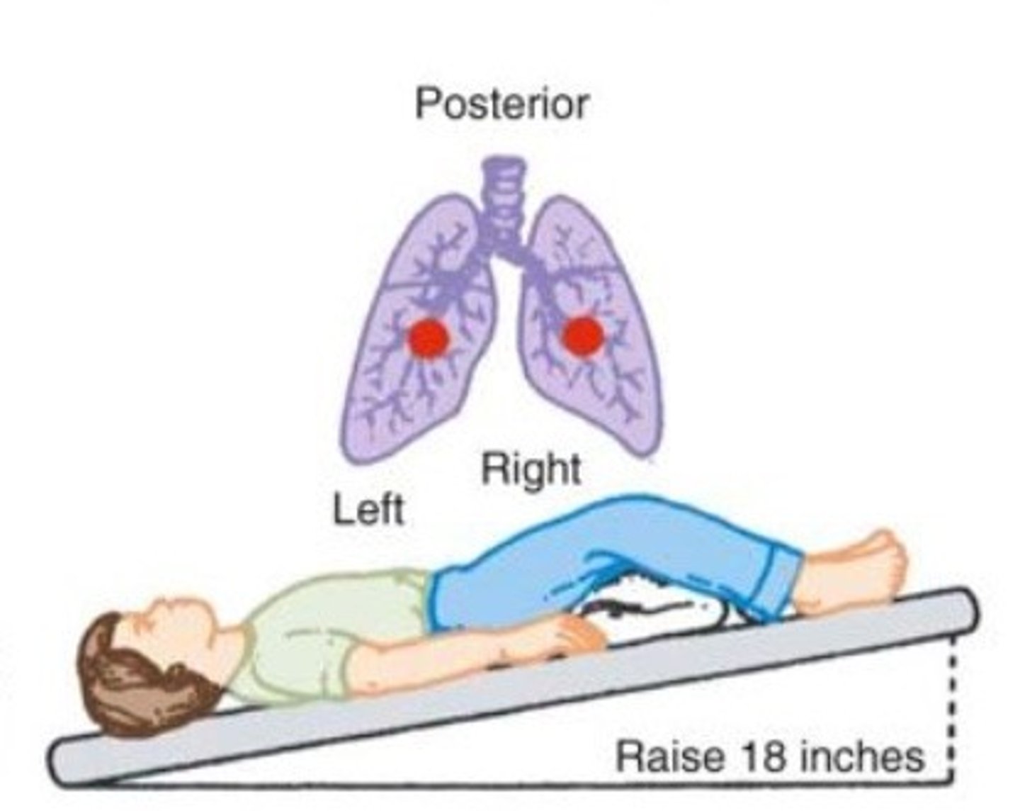 <p>- Position the patient supine with the foot of the bed elevated 18 - 20 inches.</p><p>- Area to percuss is over the lower ribs.</p>