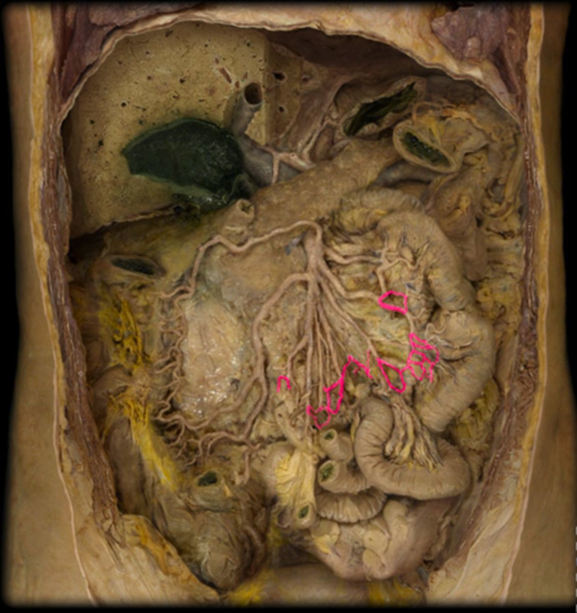 <p>artery</p>