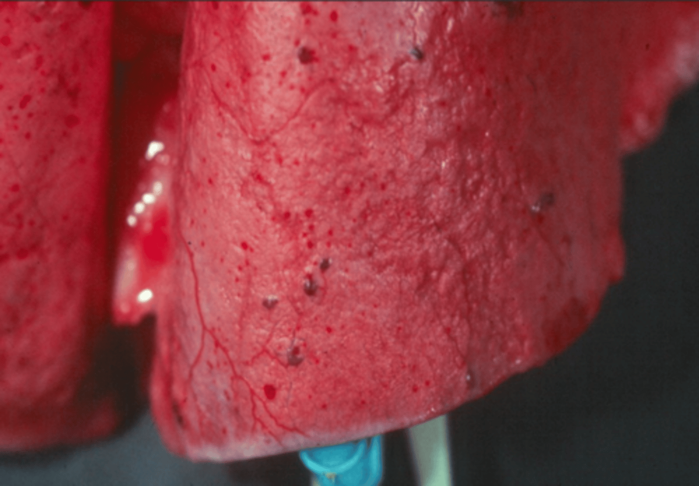 <p>sheep lung. which parasite has infected it? what is the name for this disease?</p>