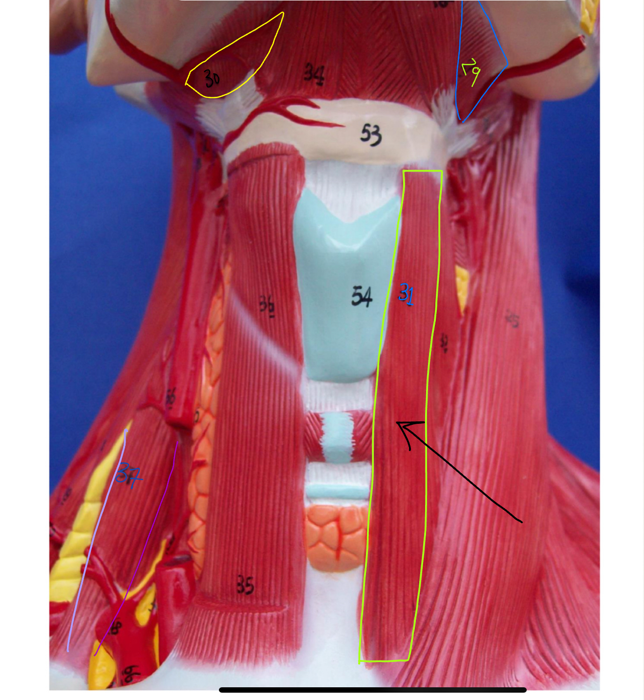 <p>What type of muscle is this ( altay model )</p>