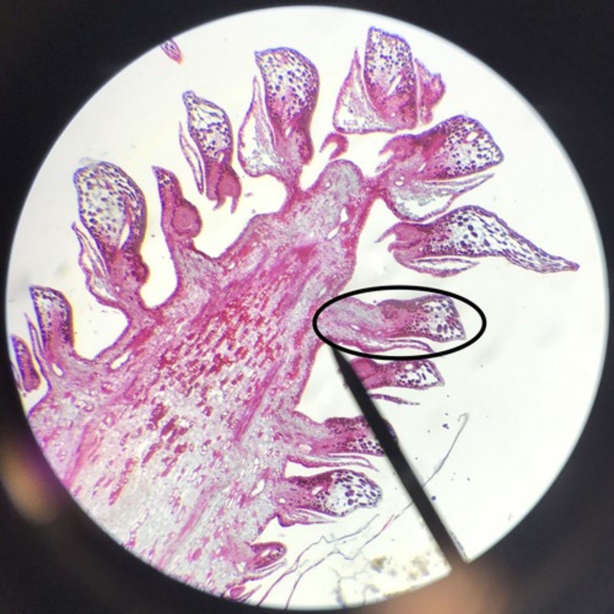 <p>two ovules, ovuliferous scale, sterile bract</p>