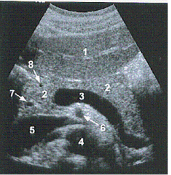 <p><span><span>Identify the vessel labelled #6 </span></span></p>