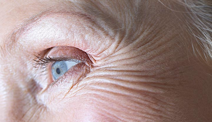 <p>Most adults in their 30s notice lines developing on their foreheads, and by their 40s these lines are accompanied by ___ feet around the eyes and lines around the mouth—markers of four decades of smiles, frowns, laughter, and other emotions.</p>