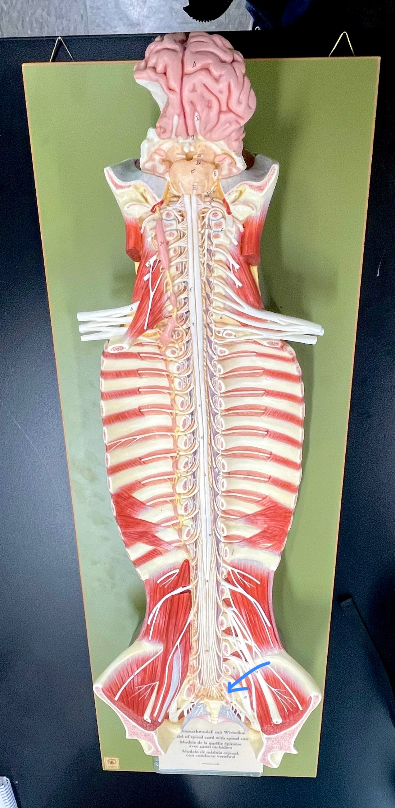 <p>What type of spinal nerve is this? How many pairs?</p>