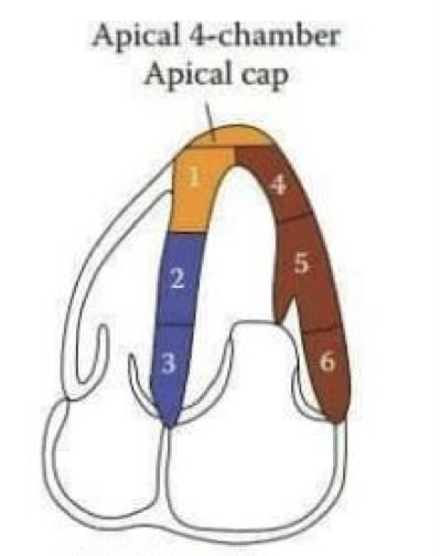 <ol><li><p>Apical septal (LAD)</p></li><li><p>Mid inferoseptal (RCA)</p></li><li><p>Basal inferoseptal (RCA)</p></li><li><p>Apical lateral (LCx)</p></li><li><p>Mid anterolateral (LCx)</p></li><li><p>Basal anterolateral (LCx)</p></li></ol>