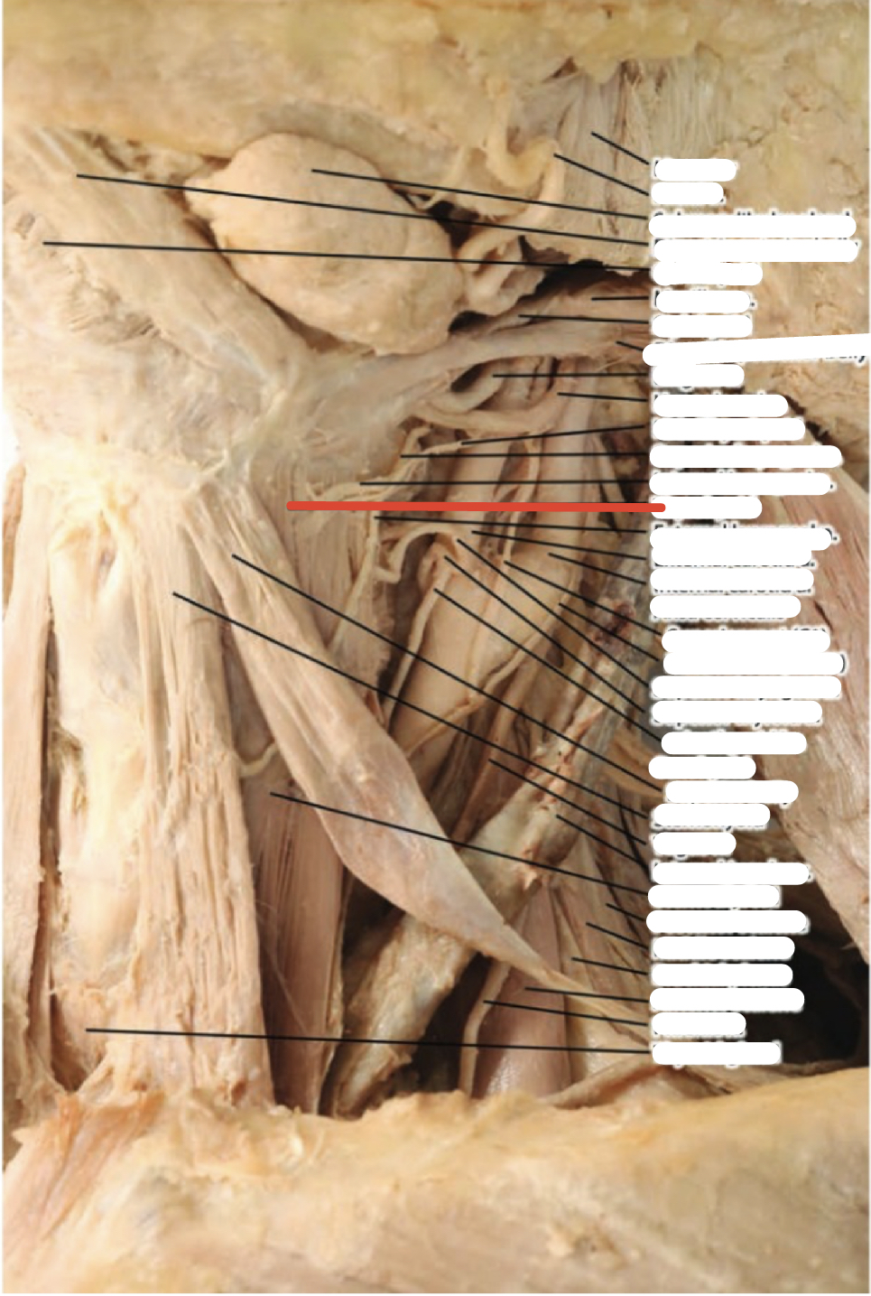 Identify the structure (red line)