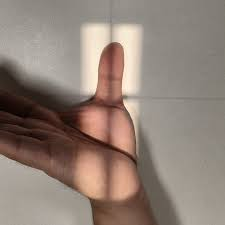 <p>AP AXIAL projection</p>