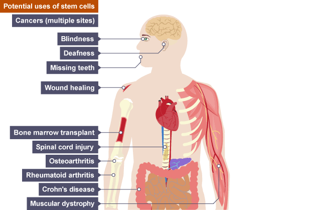 <p>Corneal transplants and skin grafts</p>