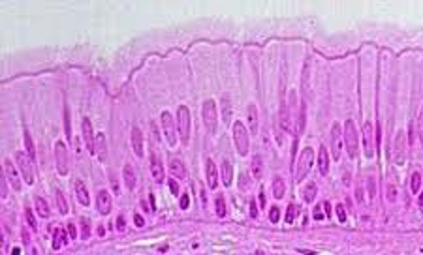 <p>air passages, reproductive tract</p>