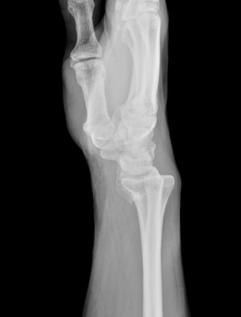 <p>Describe the abnormality demonstrated.</p>