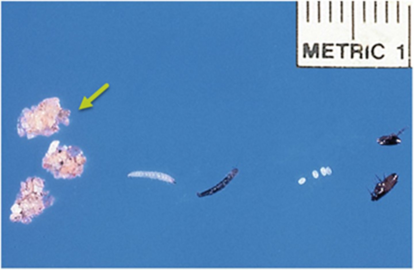 <p>The yellow arrow points out the _______ life cycle stage of the flea.</p>