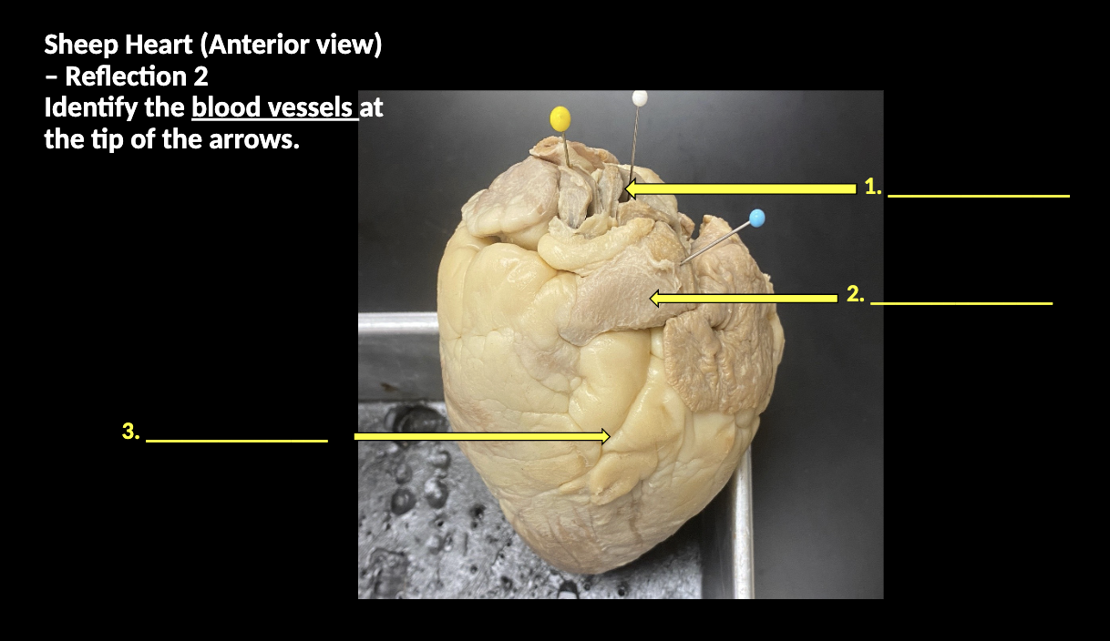 <p>Identify the blood vessels at the tip of the arrows (lowk not sure about this one)&nbsp;</p>