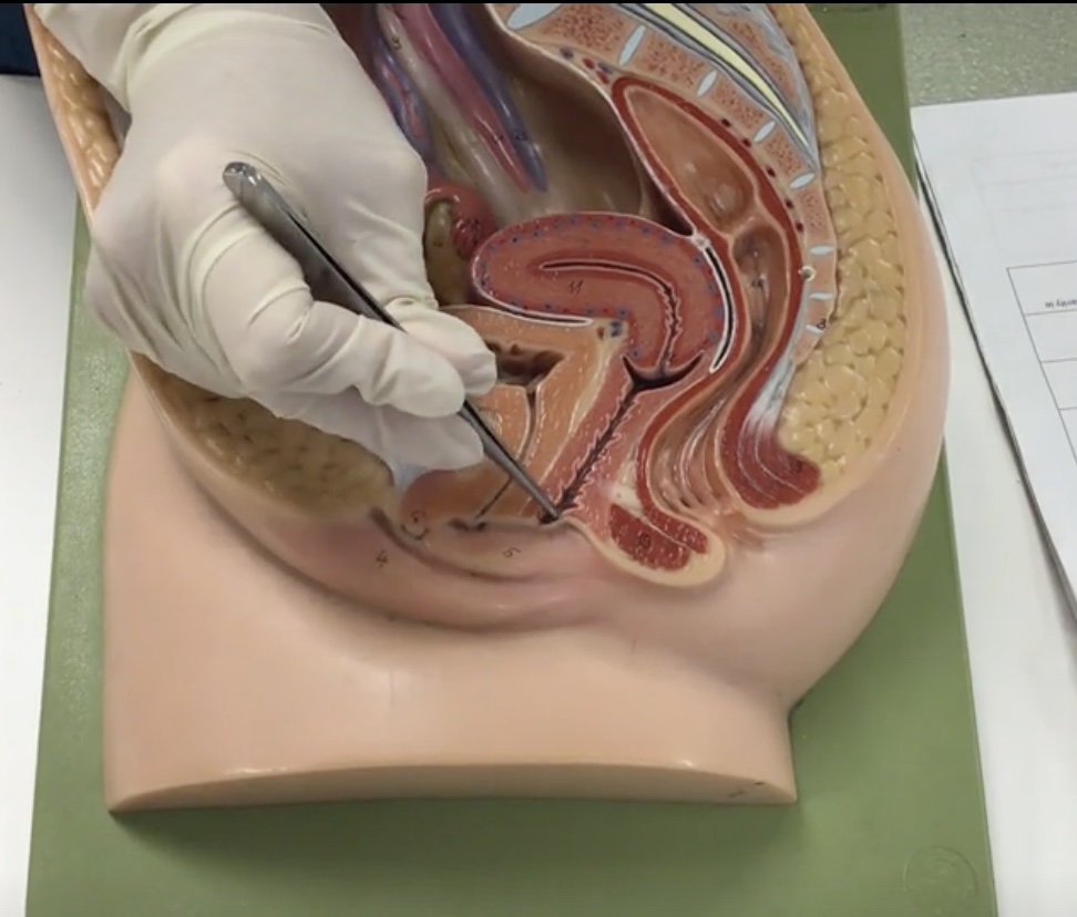 <p>Description: Thin, membranous covering vaginal orifice</p><p>Relationship: N/A</p>