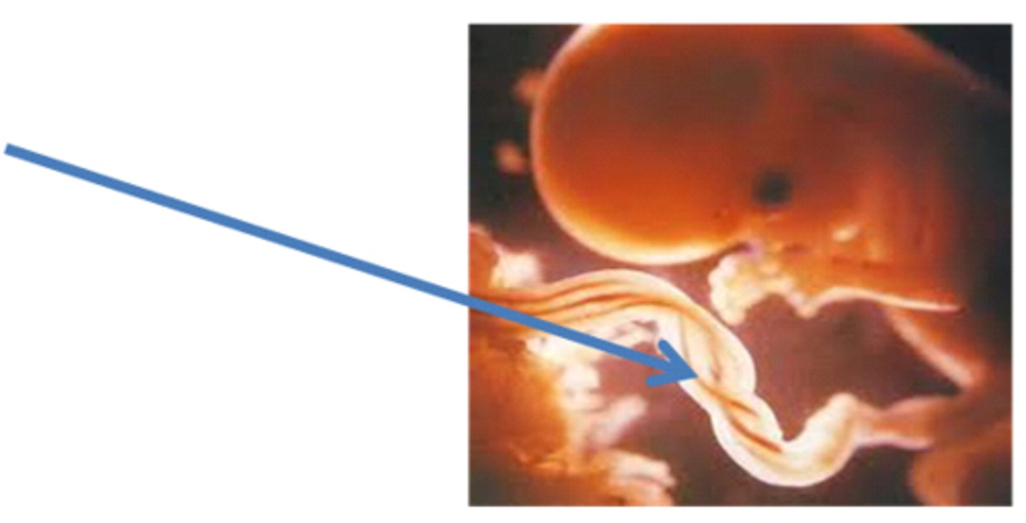 <p>Site of exchange of oxygen-rich blood between fetus and mother</p>