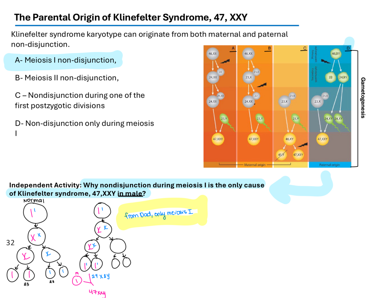 <p>A genetic condition in males caused by an extra X chromosome (trisomy) (47,XXY) leading to physical and cognitive developmental issues.</p><p>It is the first human sex chromosome abnormality to be reported the incidence is estimated to be between 1 in 500 and 1 in 1000 male neonates </p><p>Males with Klinefelter syndrome do not produce enough of the male hormone testosterone resulting in a lack of normal male sexual characteristics </p><p>Infertility </p><p>Klinefelter syndrome karyotype can originate from both maternal and paternal non-disjunction </p>