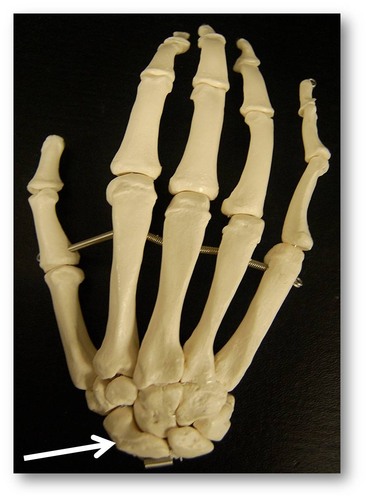 Name this specific bone of the hand (posterior view).