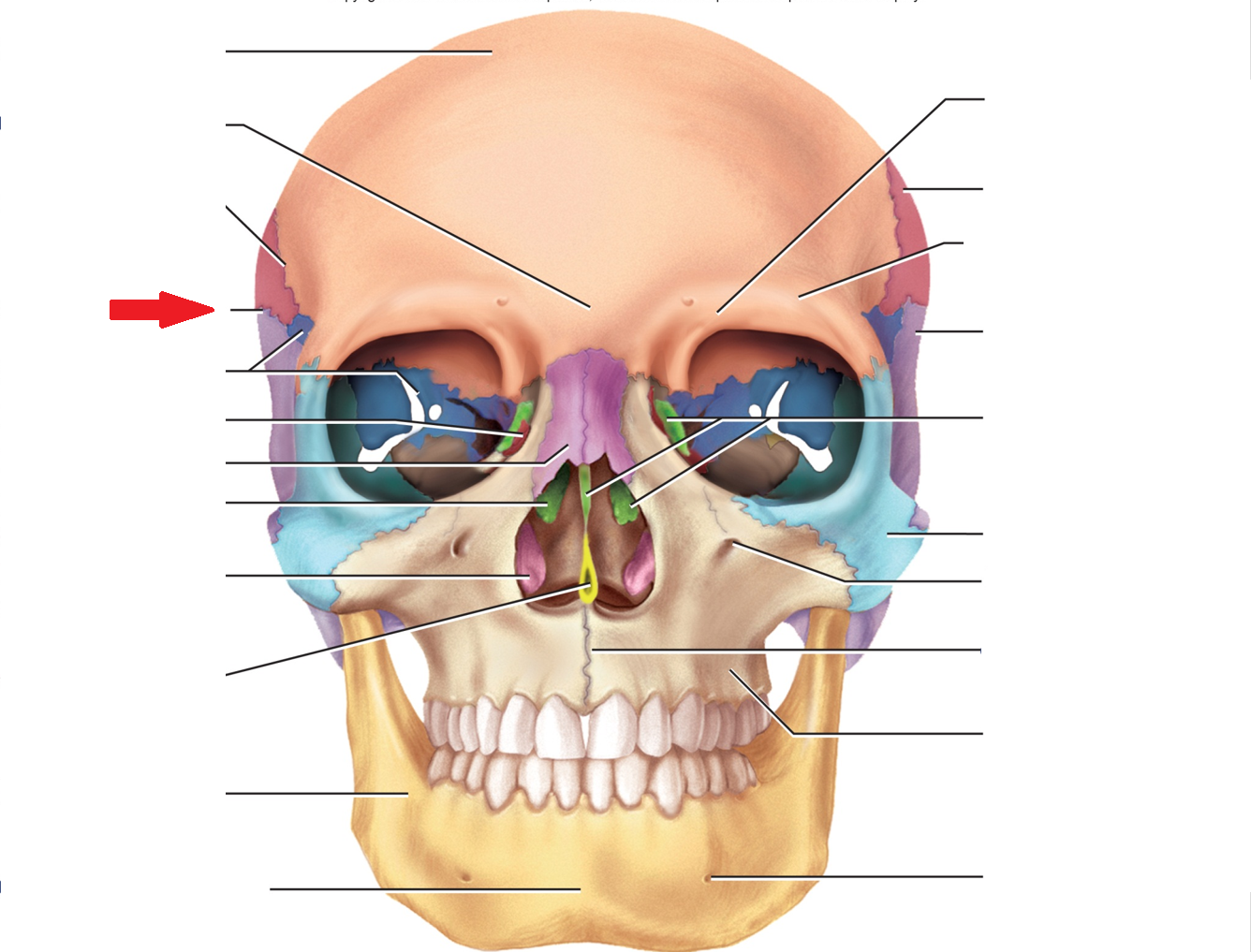 term image