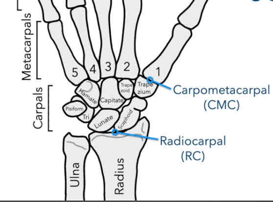 <p>Between the carpals and metacarpals</p>