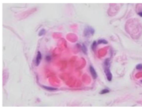 <p>Angiv epitheltypen (blodkar)</p>