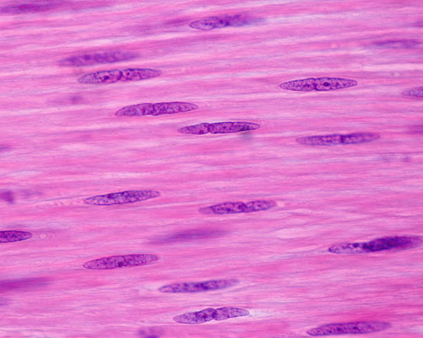 <p>Smooth, Cardiac, or Skeletal tissue?</p>