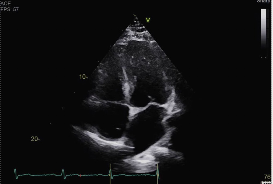 <p>Identify the view and structures</p>