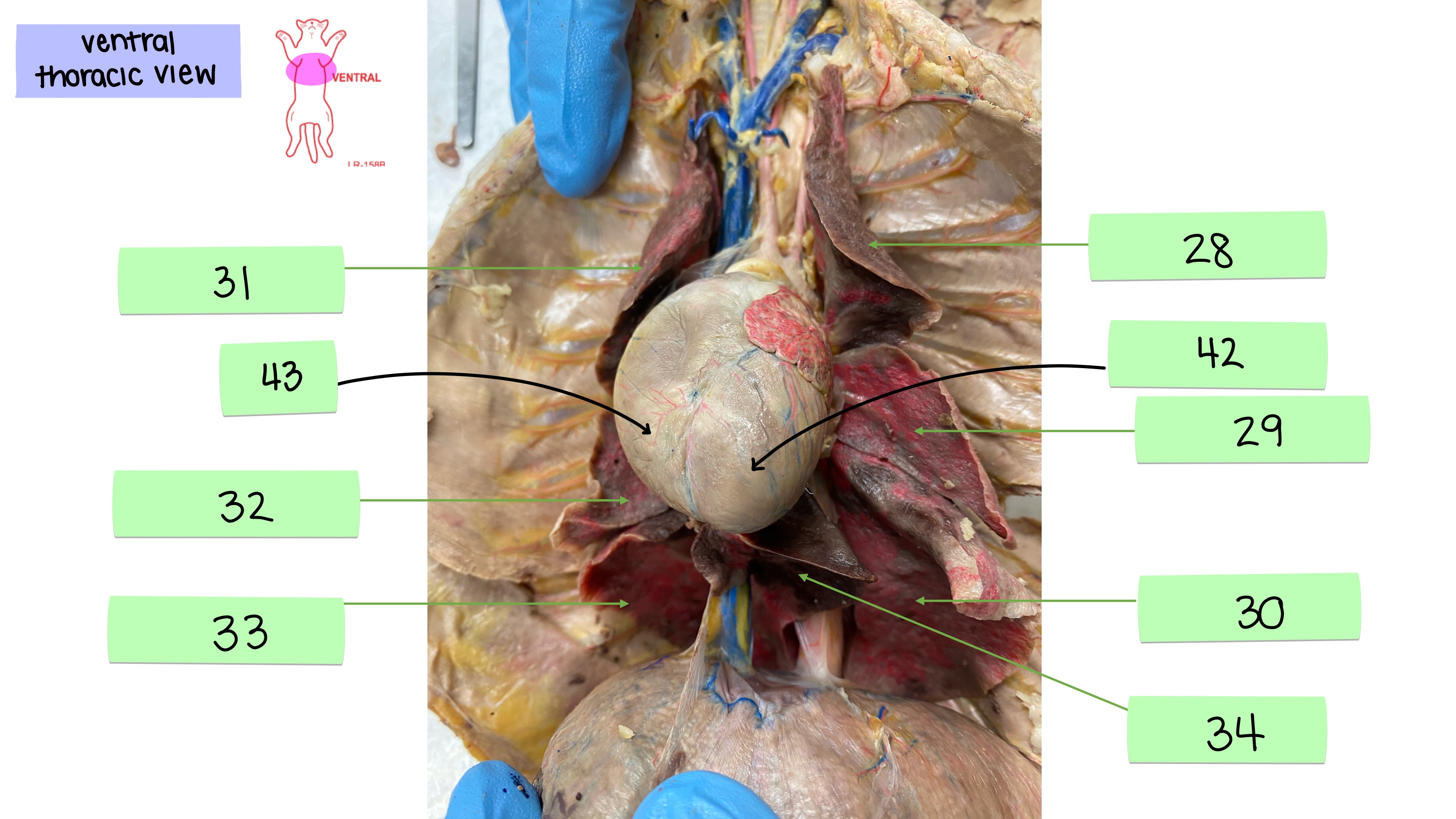 <p>right ventricle</p>