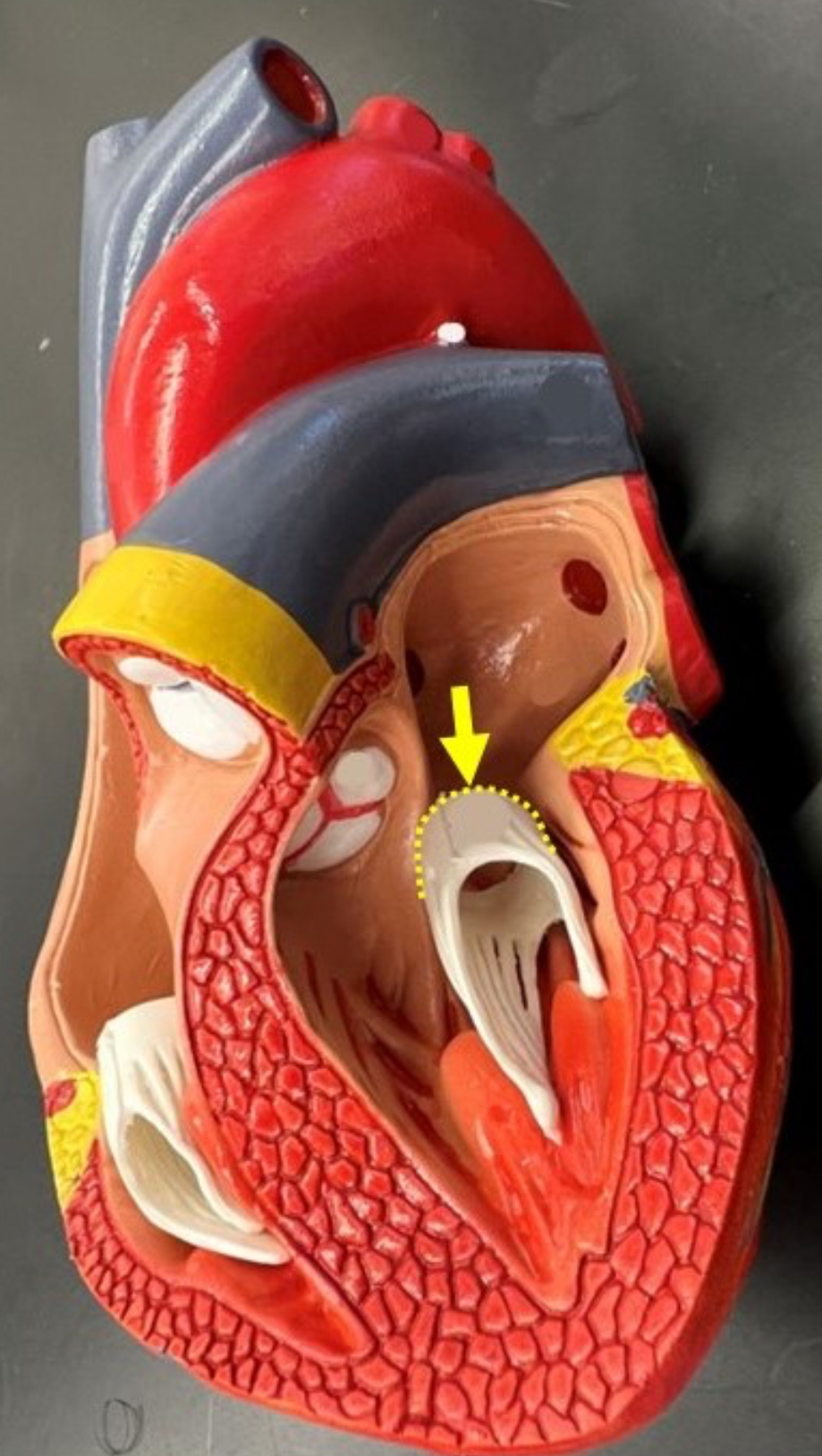 term image