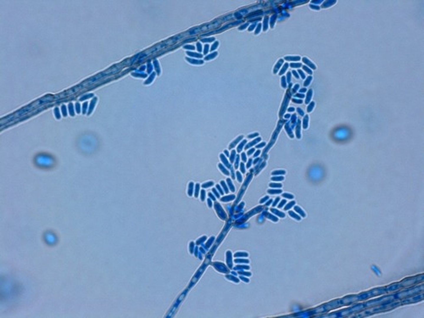 <p>colony: mucoid changing to velvet</p><p>--dark brown-black</p><p>--reverse (same)</p><p>Young culture: yeast-like cells</p><p>Mature colonies: pointed annelides branch from hyphae</p><p>--conidia cluster at tipe (cylindrical-oval)</p><p>septate hyphae</p><p>Disease:</p><p>Cutaneous: phaehyphomycosis granular cysts (immunocompetent)</p><p>Systemic: affinity for CNS, eyes (immmunocompromised)</p><p>*yeast-like fungus</p>