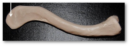 Name this specific part of the clavicle.