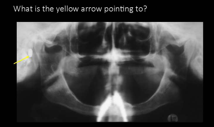 <p> What is the yellow arrow pointing to?</p>