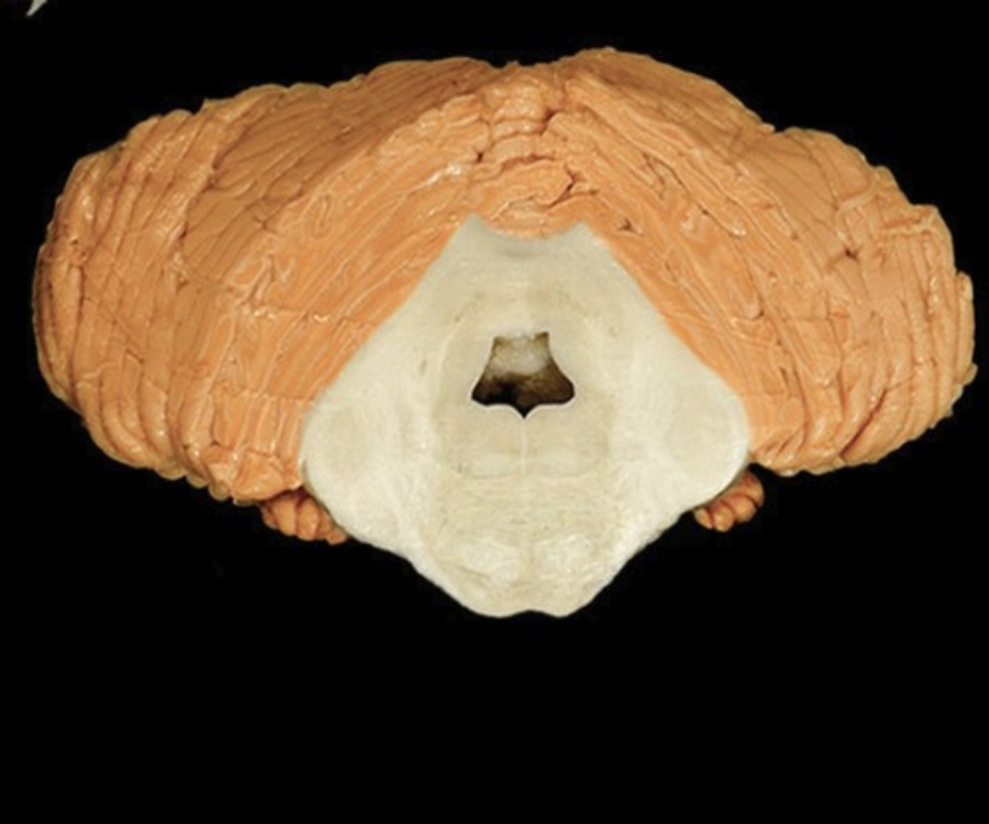<p>Name this structure</p>