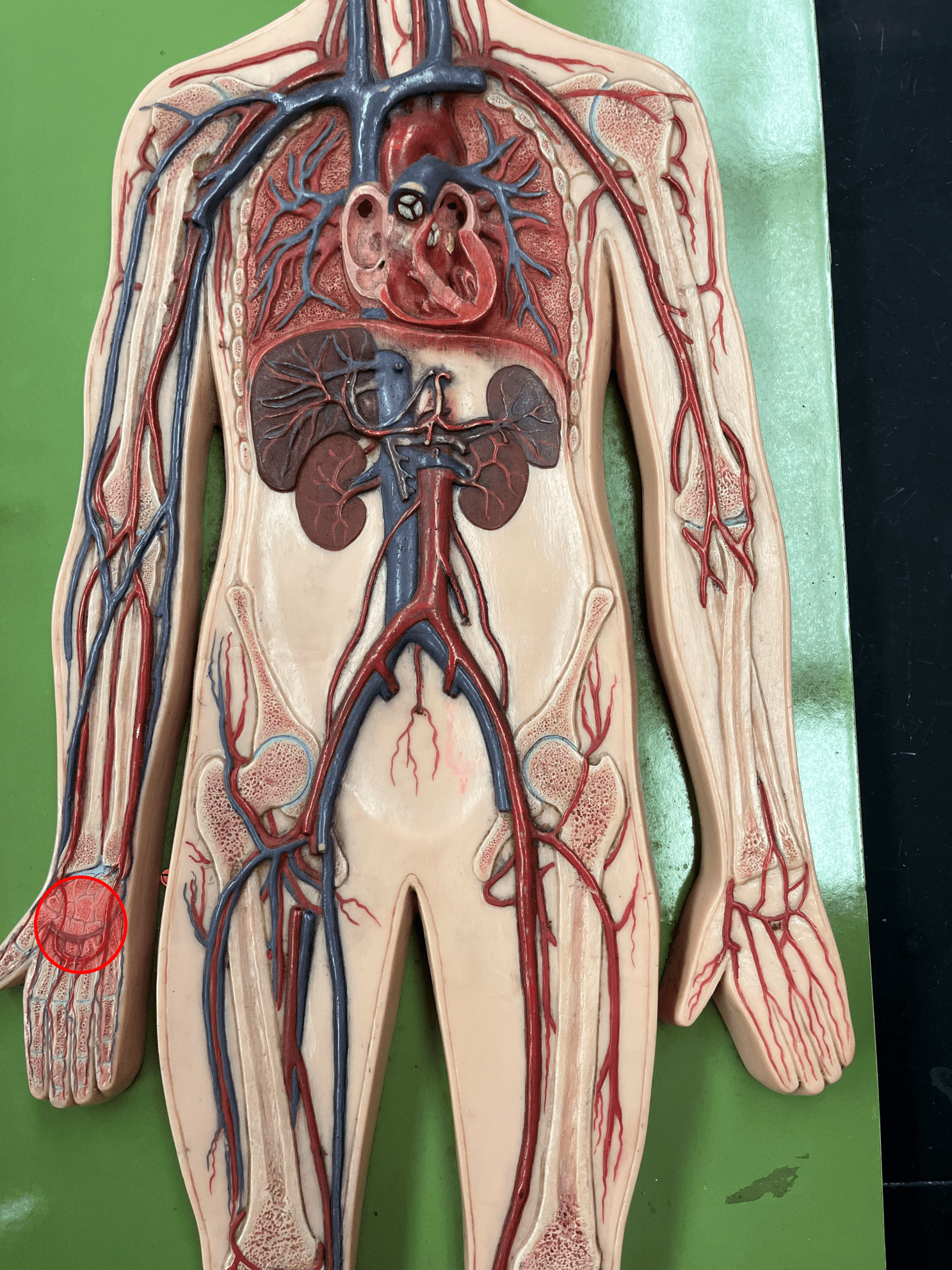<p>• An artery of the upper limb.</p>
<p>• Originates from the convergence of the radial and ulnar arteries.</p>
<p>• Supplies the palm and fingers.</p>