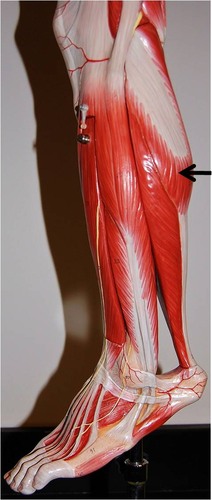 <p>Action: PRIME MOVER- (with soleus) plantar flexion of foot; also flexes knee Insertion: calcaneus (via the calcaneal tendon)</p>