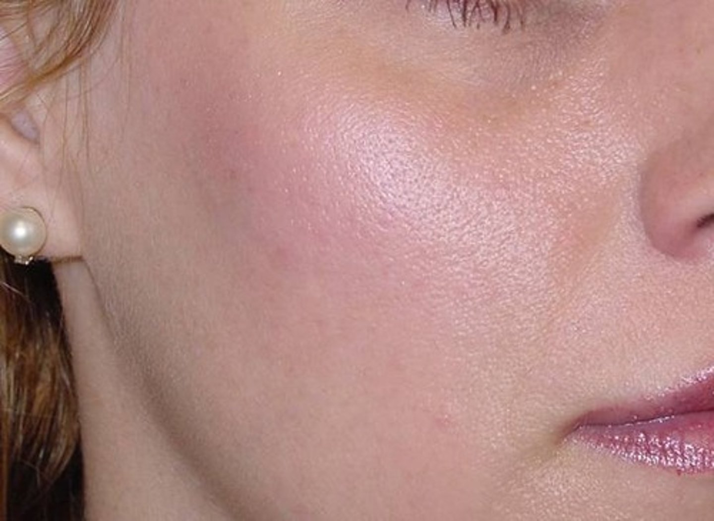 <p>the cheek</p>