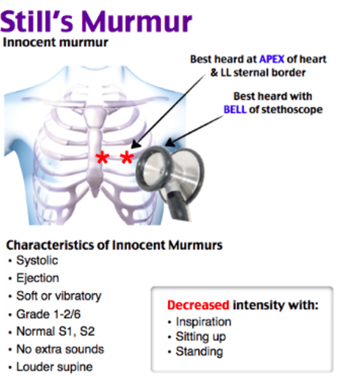 <p>Ans: C</p><p>Chapter: 18</p><p>Page and Header: 822, Assessing Young and School-Aged Children</p><p>Feedback: This description is consistent with Still's murmur, a very common and benign murmur of childhood. Tricuspid and mitral stenosis would be diastolic murmurs and the venous hum is usually not heard in this area. Further evaluation is usually not necessary.</p>