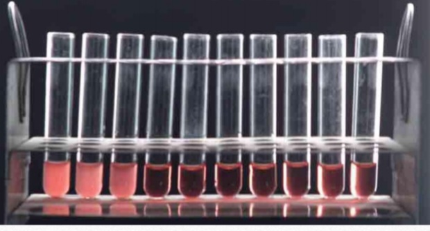 <ol><li><p>Name the test </p></li><li><p>Principle of the test</p></li><li><p>The test is used for ………</p></li><li><p>The indicator system in this test consists of ………</p></li></ol>